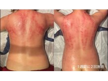 エクラ(eclat)/セルクラ