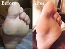 レーヌ青山(Reine Aoyama)/施術★ドイツ式フットALL美脚