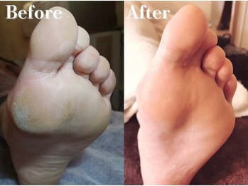 レーヌ青山(Reine Aoyama)/施術★ドイツ式フットALL美脚