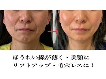 『元の顔を忘れた！綺麗な顔で毎日楽しいんです！』