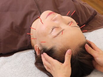 シフク鍼灸整体院/鍼と髪