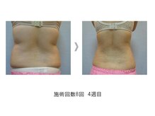 まごころ整体院/痩身