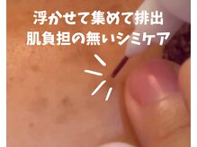 フォーチューン/シミケアフェイシャル♪