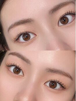 ズール(ZUL)/束感派？ノーマル派？