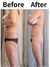 ポノ(pono)/WINBACK施術＆栄養療法