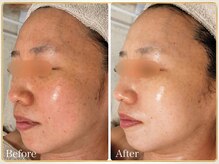 ロイヤル(ROYAL)の雰囲気（トロイアルケで年齢肌改善◎口コミ多数♪）