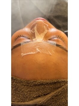 毛穴ケア専門店 Clear Whiteの写真/長年の「いちご鼻」もプロの技術で徹底洗浄◎毛穴の奥まで大掃除して、ノーファンデの素肌美人に！