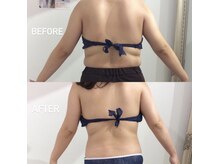 エスグレース 梅田店(S.grace)/背中美人に！