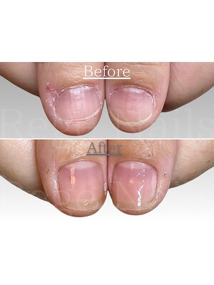 たまプラーザネイルサロン【Rege Nails】自爪育成・爪と手肌の専門サロン