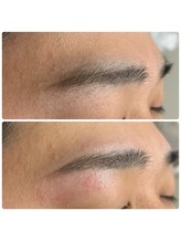 バブル(BUBRU)/まゆ脱毛