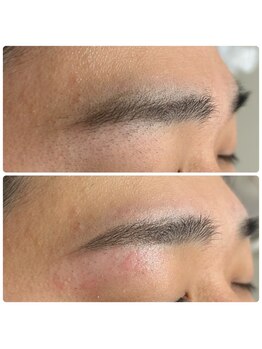 バブル(BUBRU)/まゆ脱毛