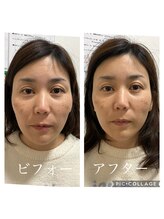 呼吸の音/★フェイスライン変化☆