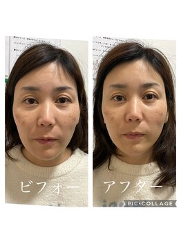 呼吸の音/★フェイスライン変化☆