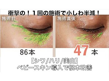 ボディアーキ 中野店(BODY ARCHI)/【シワ/ハリ/美白】根本改善