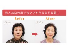美容整体すこやか/BeforeーAfter