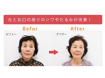 美容整体すこやか/BeforeーAfter