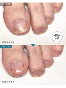 BEFORE/AFTER　月額会員様です♪