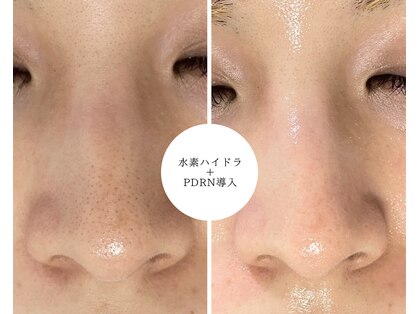 ベル(Belle)の写真