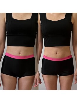 美骨矯正サロン メディカルカイロテルボ 高田馬場店/【肋骨締め・骨盤締め】（痩身）