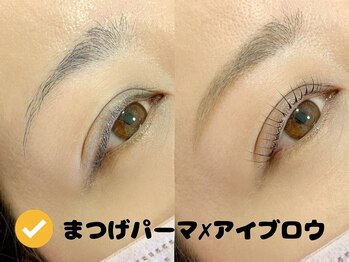 リマ(Lima)/同時施術