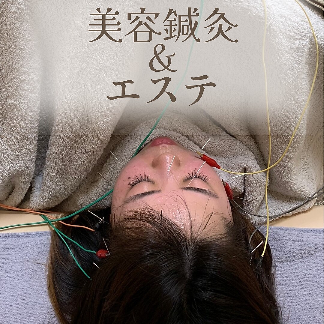 美容鍼灸28本むくみ顔の引き上げコース 顔・頭ツボ押し付き