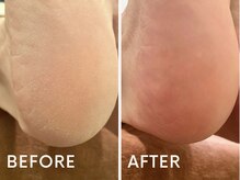 ダリアス ネイルサロン/フットケア施術例