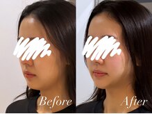 ハクト(Hakuto)/Before/After