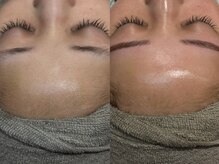 スタジオテーラーシックス(STUDIO TAILORSIX)/毛穴ケア韓国肌管理/NMN幹細胞