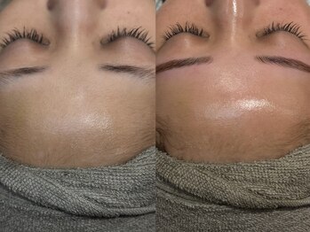 スタジオテーラーシックス(STUDIO TAILORSIX)/毛穴ケア韓国肌管理/NMN幹細胞