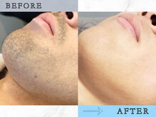 ラッシュ(RUSH)/初回→13回目