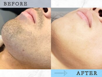 ラッシュ(RUSH)/初回→13回目