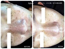 クリニカルエステ リフィーナ 西荻窪店の雰囲気（シミケアも毛穴ケアも一度につるんと解消♪メンズも◎）