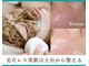 シーズン(Season)の写真/ぽっかり毛穴、黒ずみ毛穴に！ハーブピーリング×コラーゲン産生マシンで引き締まった理想肌へ