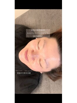 ベル(Belle)/【艶玉肌セルマン】