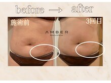 アンバー 恵比寿(AMBER)/ストレッチを目立ちにくくしたい