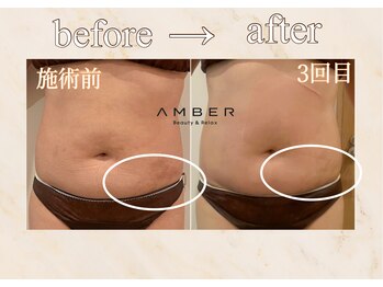 アンバー 恵比寿(AMBER)/ストレッチを目立ちにくくしたい