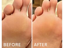 ダリアス ネイルサロン/フットケア施術例