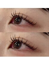 ミニョン(Mignon)