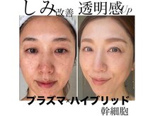 トータルエステティック ジョワイユ(JOYEUX)