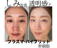 トータルエステティック ジョワイユ(JOYEUX)