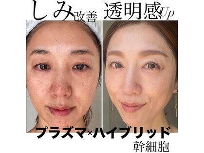 トータルエステティック ジョワイユ(JOYEUX)の写真