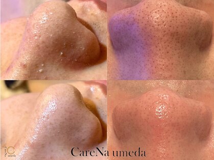 ケアナ 梅田店(CareNa)の写真