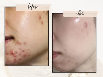 リマイン(Re mine)