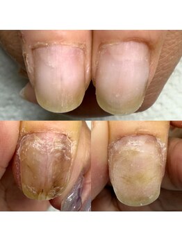 ウェルズユキ(well's yuki)/