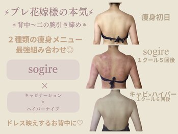 エステティックサロン アールグレー 名古屋駅店/2種の痩身メニュー組み合わせ◎