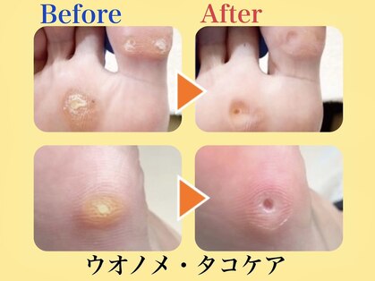 巻き爪補正店 北千住店の写真