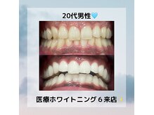 カウラ(Kaula)の雰囲気(垢抜けに最適! 輝く笑顔は、白い歯から。メンズも大歓迎!)