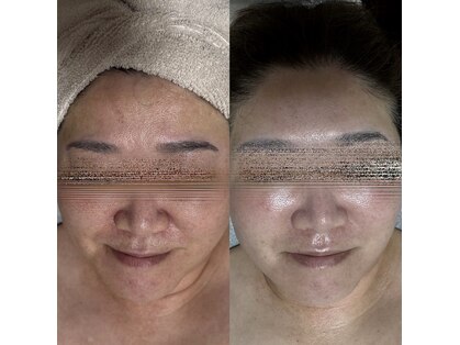 ミレラ(Mirela)の写真