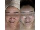 ミレラ(Mirela)の写真