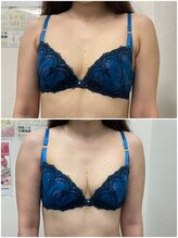 バーディー(BIRDIE)/施術1回/30代